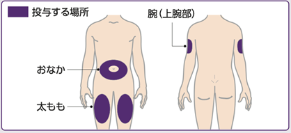 投与方法